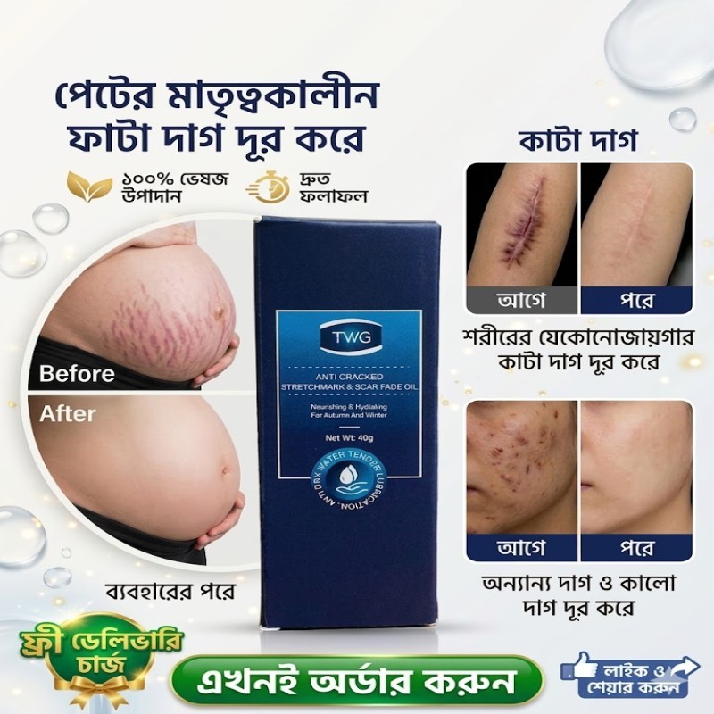 (2 ps) STRETCHMARK & SCAR FADE OIL